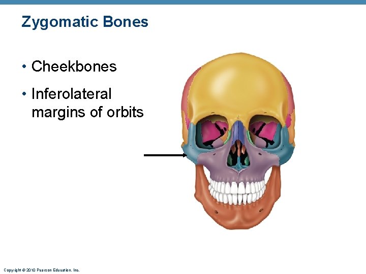 Zygomatic Bones • Cheekbones • Inferolateral margins of orbits Copyright © 2010 Pearson Education, Zygomatic Bones • Cheekbones • Inferolateral margins of orbits Copyright © 2010 Pearson Education,