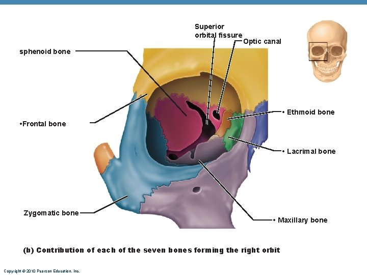 Superior orbital fissure Optic canal sphenoid bone • Ethmoid bone • Frontal bone • Superior orbital fissure Optic canal sphenoid bone • Ethmoid bone • Frontal bone •