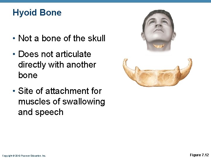 Hyoid Bone • Not a bone of the skull • Does not articulate directly Hyoid Bone • Not a bone of the skull • Does not articulate directly