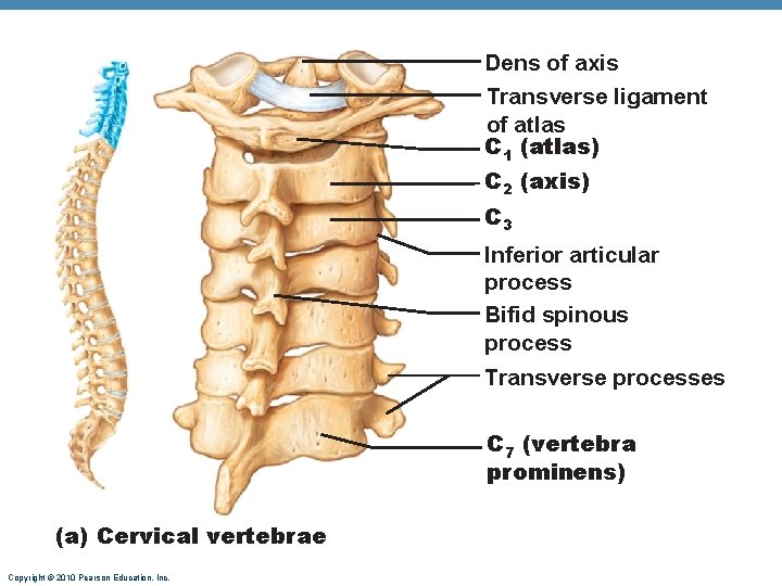 Dens of axis Transverse ligament of atlas C 1 (atlas) C 2 (axis) C Dens of axis Transverse ligament of atlas C 1 (atlas) C 2 (axis) C