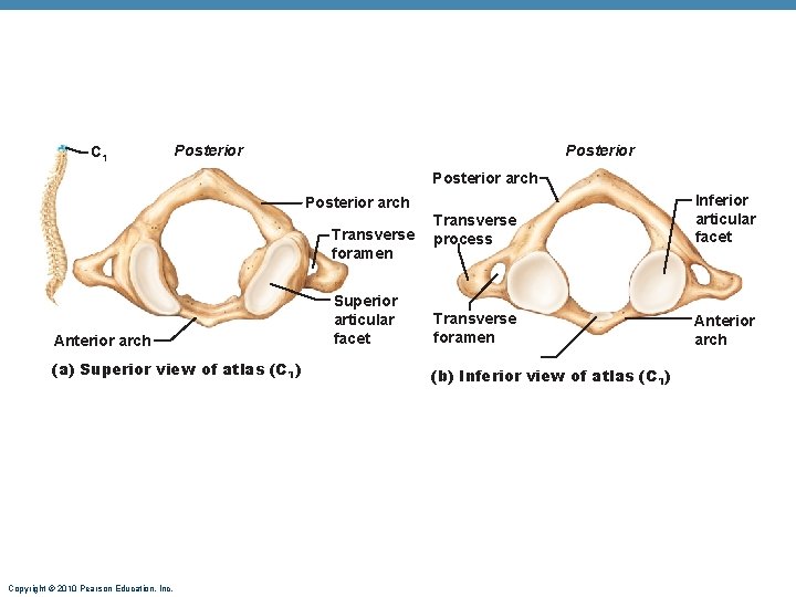 C 1 Posterior arch Transverse foramen Anterior arch (a) Superior view of atlas (C C 1 Posterior arch Transverse foramen Anterior arch (a) Superior view of atlas (C
