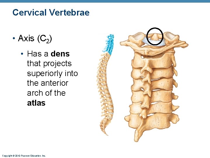 Cervical Vertebrae • Axis (C 2) • Has a dens that projects superiorly into Cervical Vertebrae • Axis (C 2) • Has a dens that projects superiorly into