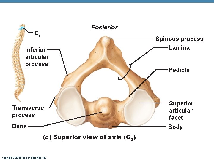 Posterior C 2 Inferior articular process Spinous process Lamina Pedicle Transverse process Superior articular Posterior C 2 Inferior articular process Spinous process Lamina Pedicle Transverse process Superior articular