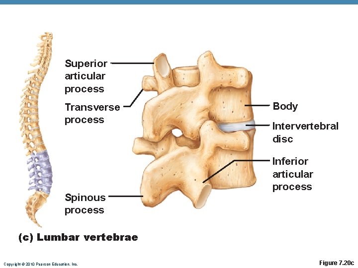 Superior articular process Transverse process Spinous process Body Intervertebral disc Inferior articular process (c) Superior articular process Transverse process Spinous process Body Intervertebral disc Inferior articular process (c)