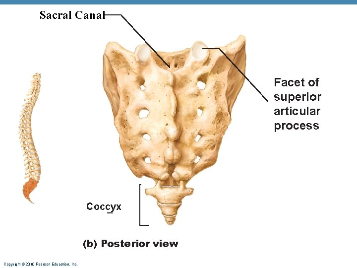 Sacral Canal Facet of superior articular process Coccyx (b) Posterior view Copyright © 2010 Sacral Canal Facet of superior articular process Coccyx (b) Posterior view Copyright © 2010