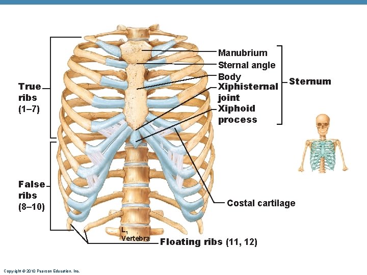Manubrium Sternal angle Body Xiphisternal joint Xiphoid process True ribs (1– 7) False ribs Manubrium Sternal angle Body Xiphisternal joint Xiphoid process True ribs (1– 7) False ribs