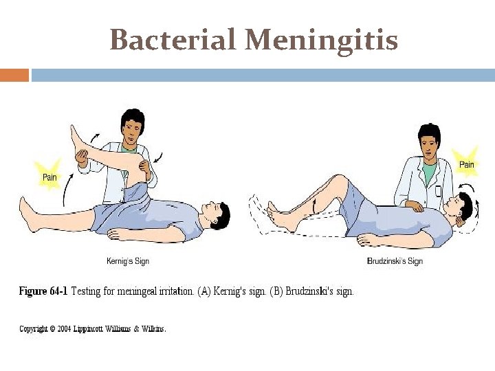 Bacterial Meningitis 