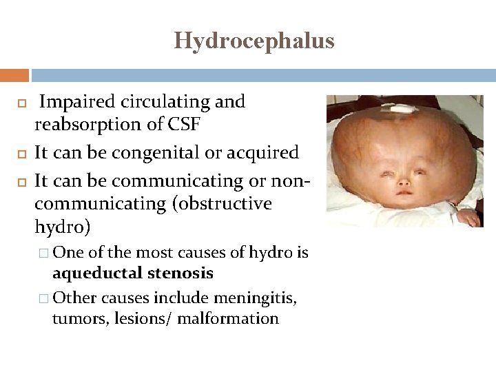 Hydrocephalus Impaired circulating and reabsorption of CSF It can be congenital or acquired It