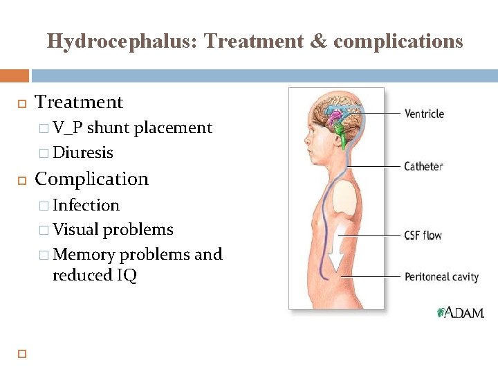 Hydrocephalus: Treatment & complications Treatment � V_P shunt placement � Diuresis Complication � Infection