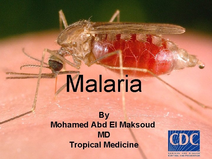 Malaria By Mohamed Abd El Maksoud MD Tropical Medicine 