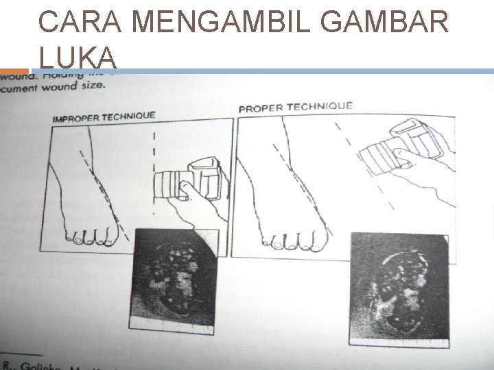 CARA MENGAMBIL GAMBAR LUKA 