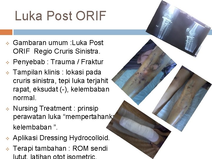 Luka Post ORIF v v v Gambaran umum : Luka Post ORIF Regio Cruris