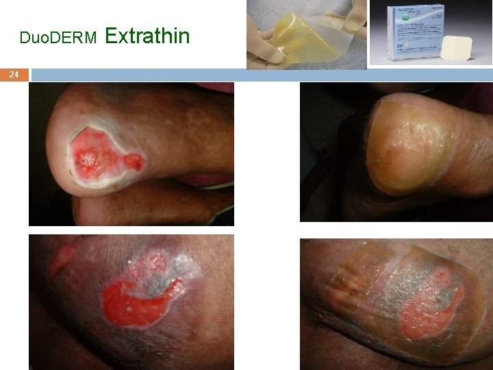 Duo. DERM Extrathin 24 