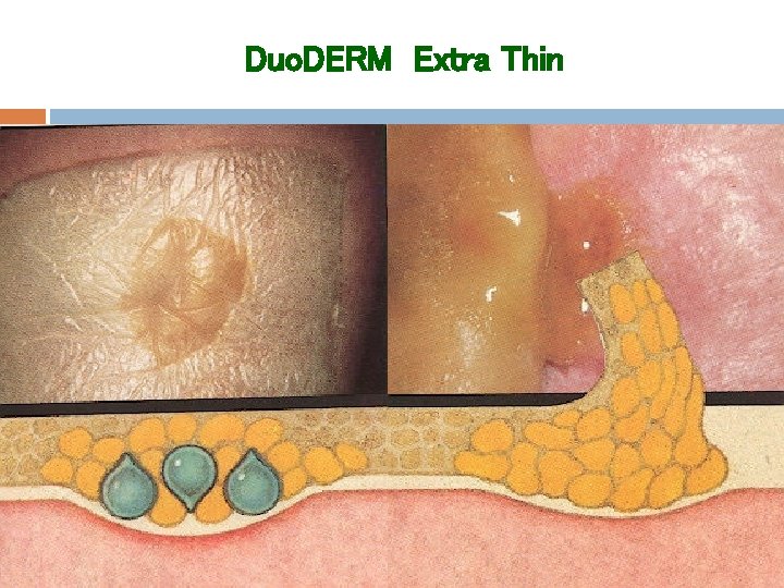 Duo. DERM Extra Thin 