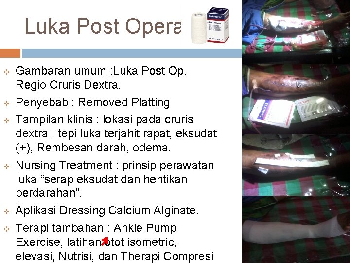 Luka Post Operasi v v v Gambaran umum : Luka Post Op. Regio Cruris