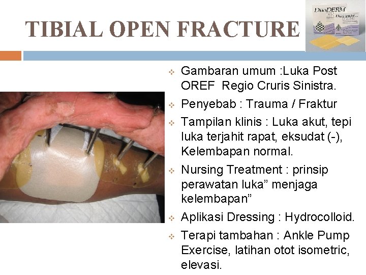 TIBIAL OPEN FRACTURE v v v Gambaran umum : Luka Post OREF Regio Cruris