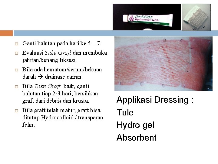  Ganti balutan pada hari ke 5 – 7. Evaluasi Take Graft dan membuka