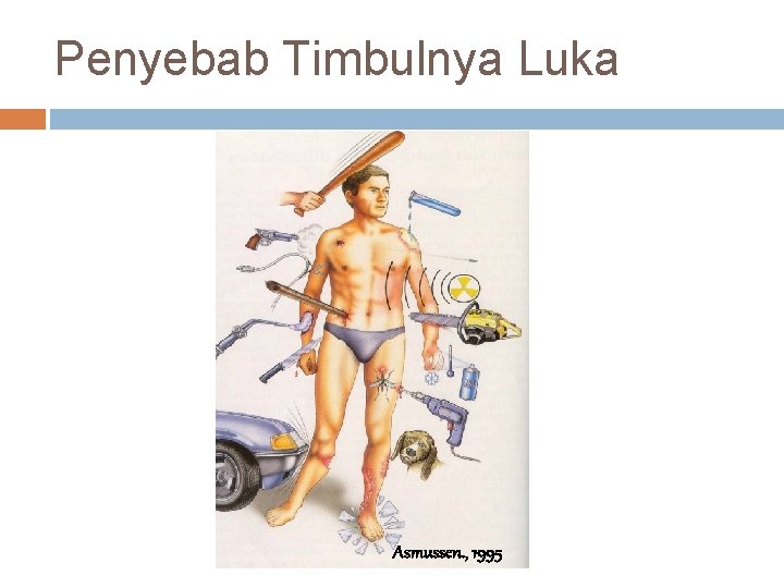 Penyebab Timbulnya Luka Asmussen. , 1995 