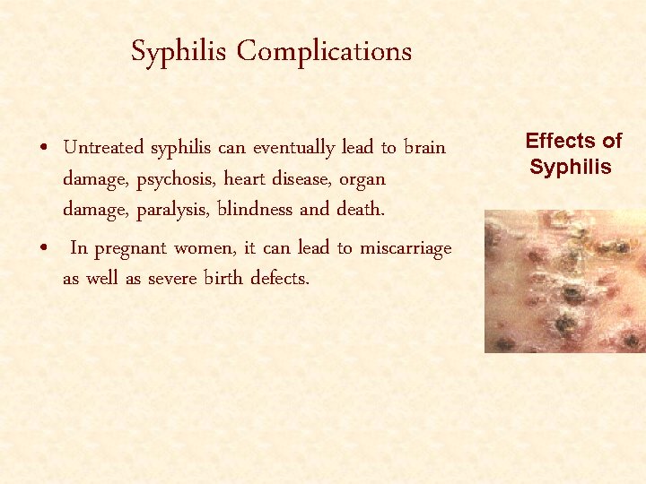Syphilis Complications • Untreated syphilis can eventually lead to brain damage, psychosis, heart disease,