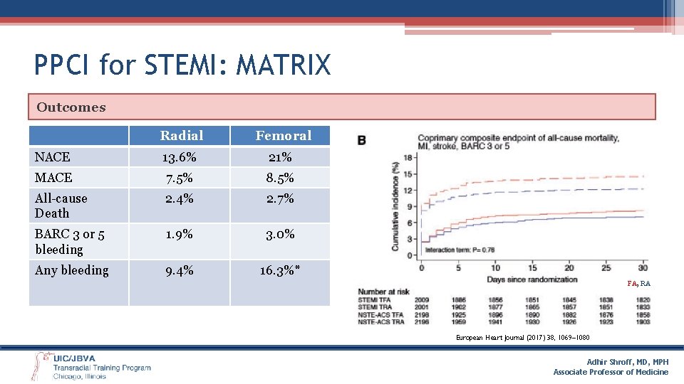 PPCI for STEMI: MATRIX Outcomes Radial Femoral NACE 13. 6% 21% MACE 7. 5%