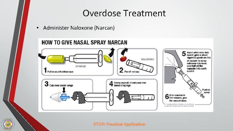 Overdose Treatment • Administer Naloxone (Narcan) STOP: Practical Application 