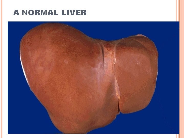 A NORMAL LIVER 