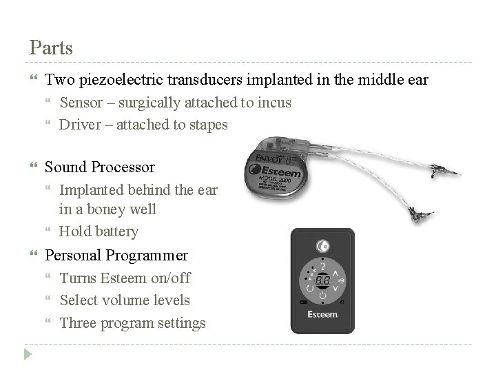 Parts Two piezoelectric transducers implanted in the middle ear Sensor – surgically attached to