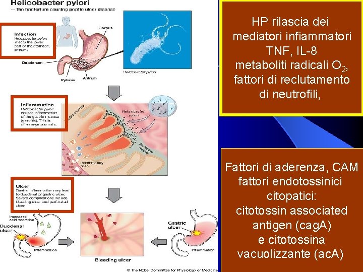 HP rilascia dei mediatori infiammatori TNF, IL-8 metaboliti radicali O 2, fattori di reclutamento