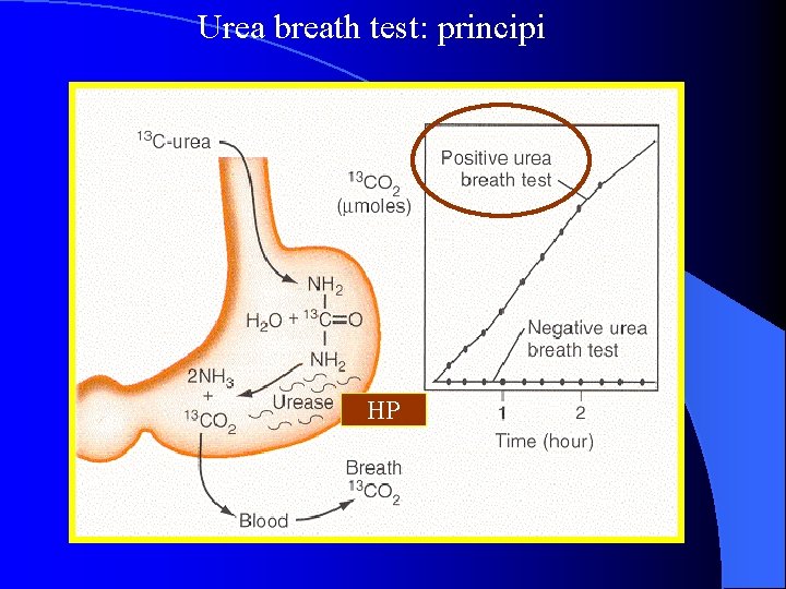 Urea breath test: principi HP 