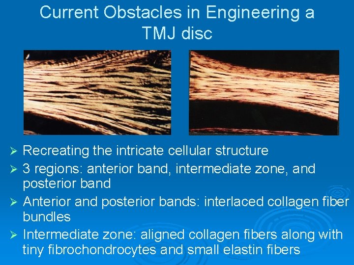 Current Obstacles in Engineering a TMJ disc Recreating the intricate cellular structure Ø 3