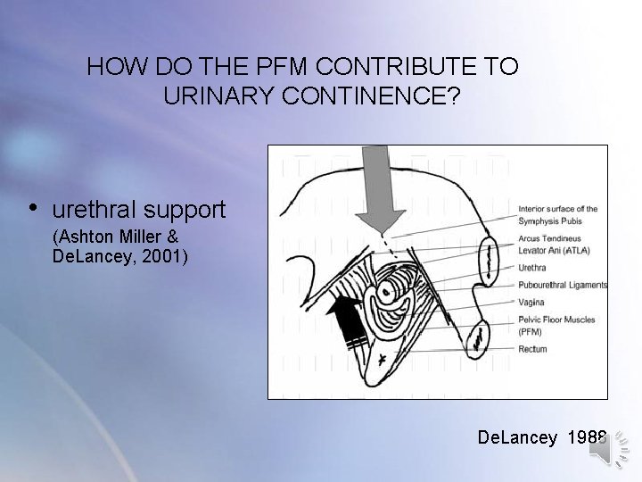 HOW DO THE PFM CONTRIBUTE TO URINARY CONTINENCE? • urethral support (Ashton Miller HOW DO THE PFM CONTRIBUTE TO URINARY CONTINENCE? • urethral support (Ashton Miller