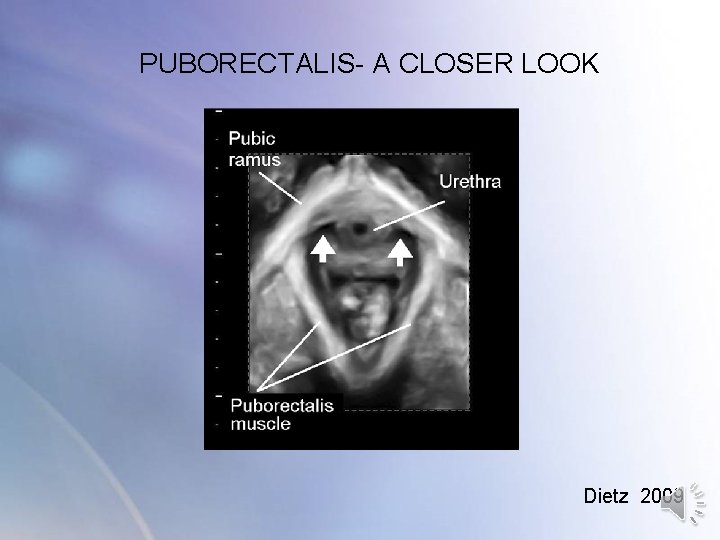 PUBORECTALIS- A CLOSER LOOK Dietz 2009 PUBORECTALIS- A CLOSER LOOK Dietz 2009