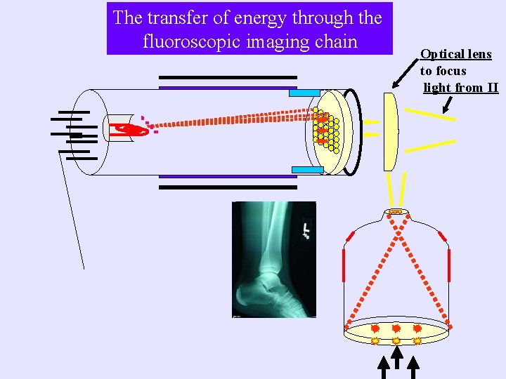 The transfer of energy through the fluoroscopic imaging chain Optical lens to focus light