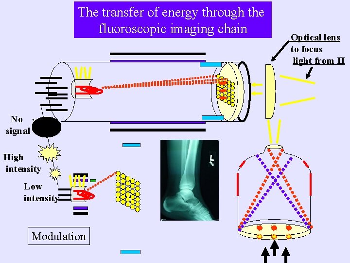 The transfer of energy through the fluoroscopic imaging chain No signal High intensity Low