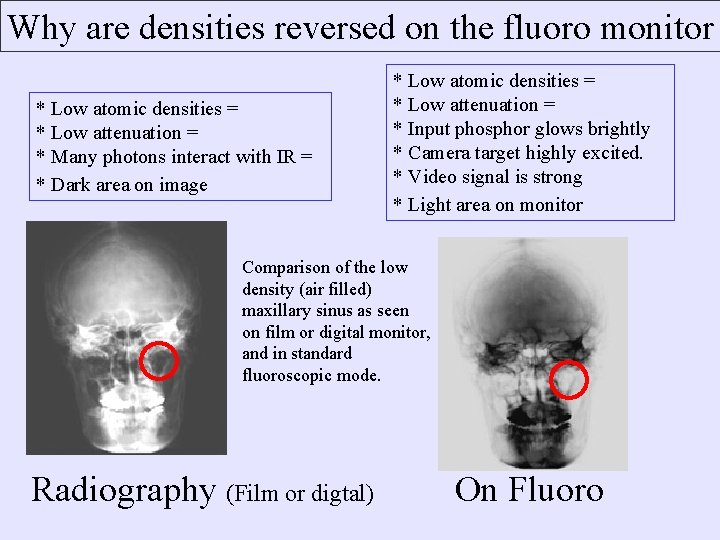Why are densities reversed on the fluoro monitor * Low atomic densities = *