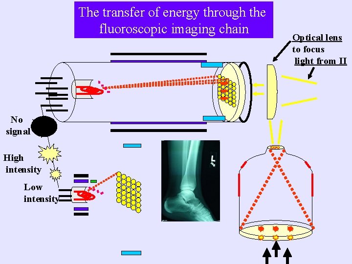 The transfer of energy through the fluoroscopic imaging chain No signal High intensity Low