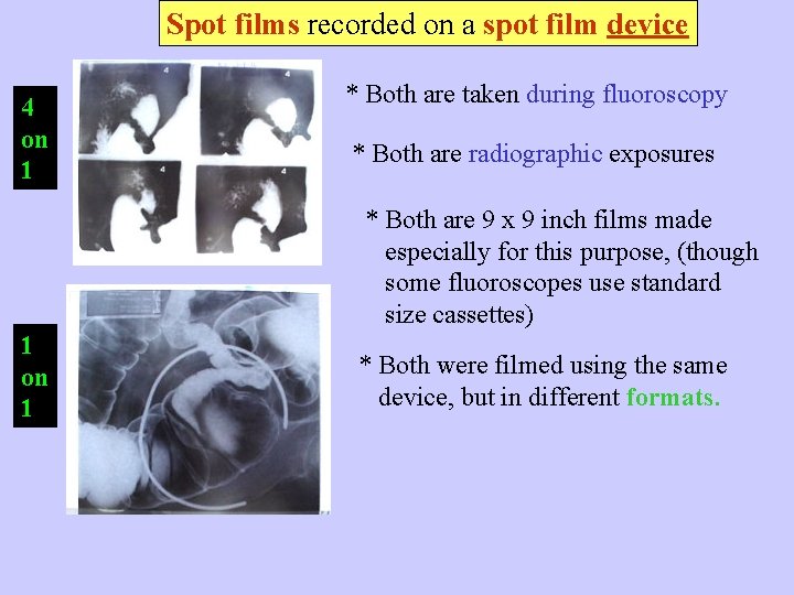 Spot films recorded on a spot film device 4 on 1 * Both are
