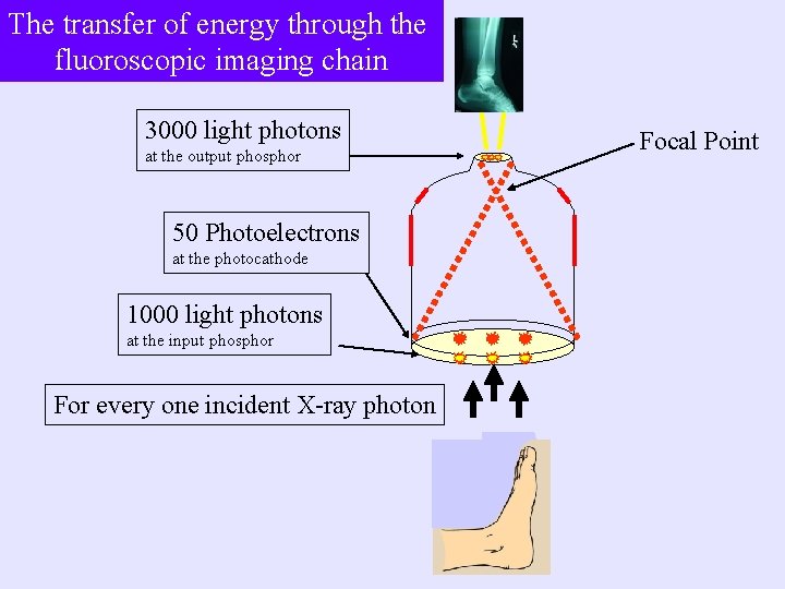 The transfer of energy through the fluoroscopic imaging chain 3000 light photons at the