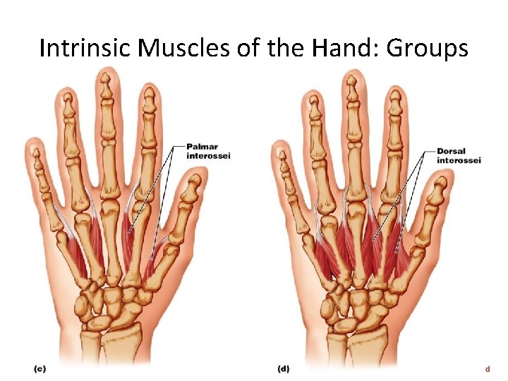 Intrinsic Muscles of the Hand: Groups Figure 10. 18 c, d 