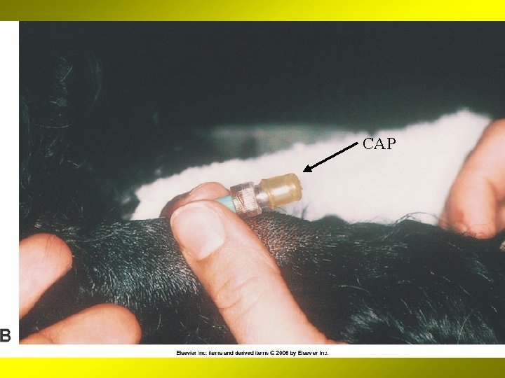 Continue Chapter 3 Diagnostic Sampling and Therapeutic Techniques