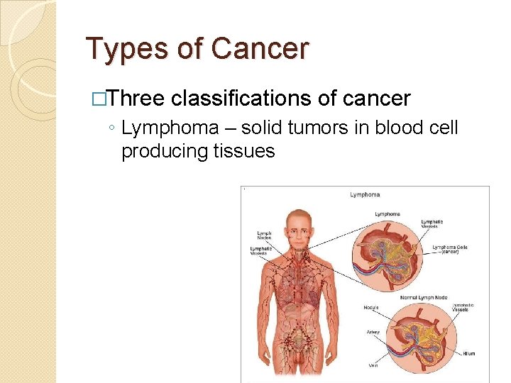 Types of Cancer �Three classifications of cancer ◦ Lymphoma – solid tumors in blood