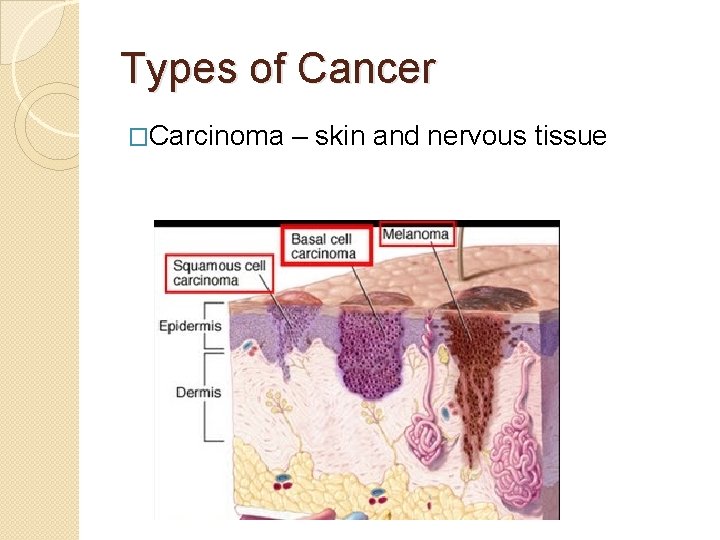 Types of Cancer �Carcinoma – skin and nervous tissue 