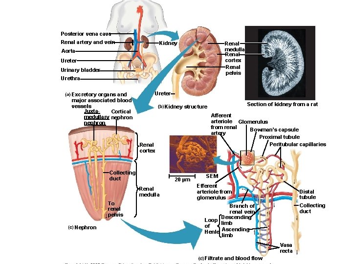 Posterior vena cava Renal artery and vein Kidney Renal medulla Renal cortex Renal pelvis Posterior vena cava Renal artery and vein Kidney Renal medulla Renal cortex Renal pelvis