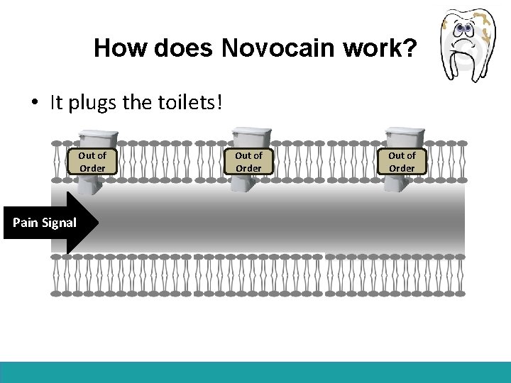 How does Novocain work? • It plugs the toilets! Out of Order Pain Signal