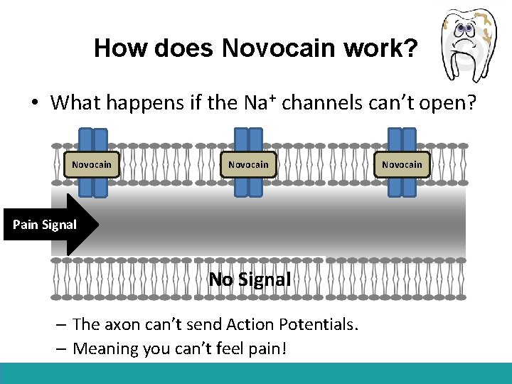 How does Novocain work? • What happens if the Na+ channels can’t open? Novocain