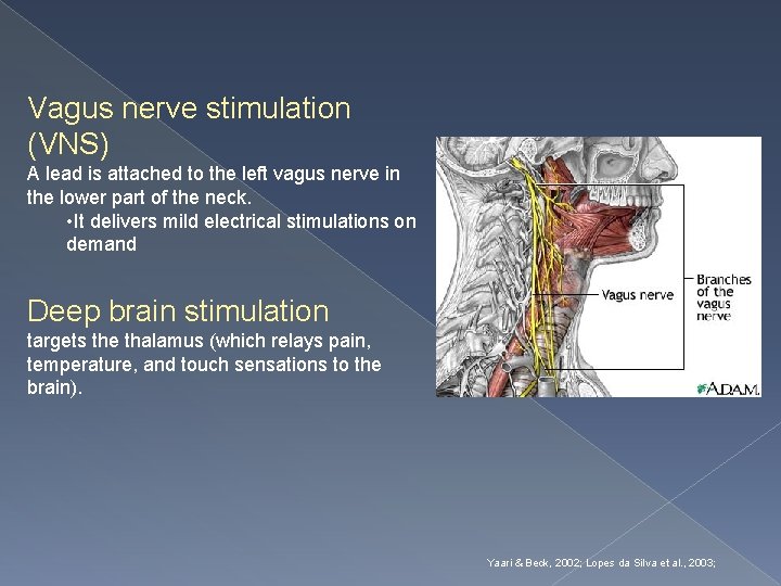 Vagus nerve stimulation (VNS) A lead is attached to the left vagus nerve in