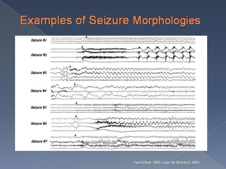 Examples of Seizure Morphologies Yaari & Beck, 2002; Lopes da Silva et al. ,