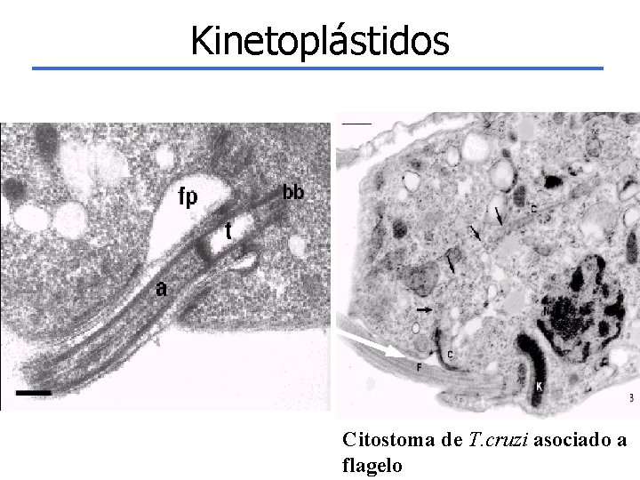 Kinetoplástidos Citostoma de T. cruzi asociado a flagelo 