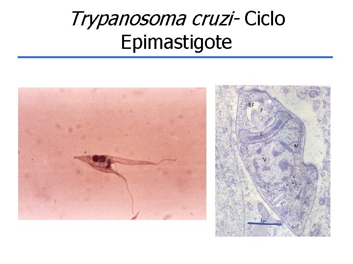 Trypanosoma cruzi- Ciclo Epimastigote 