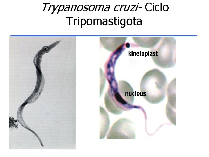 Trypanosoma cruzi- Ciclo Tripomastigota 